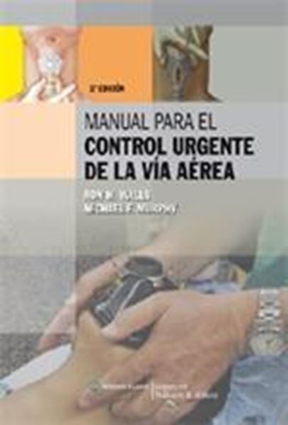 Manual para el control urgente de la vía aérea