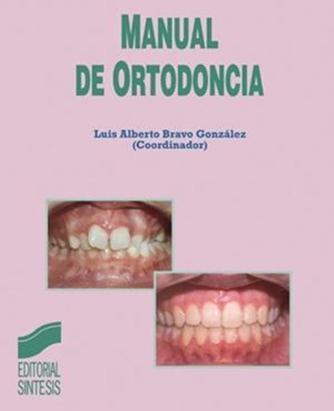 Manual de Ortodoncia