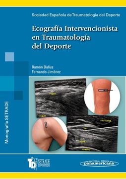 Ecografía intervencionista en traumatología del deporte "(Sociedad española de Traumatología del deporte)"