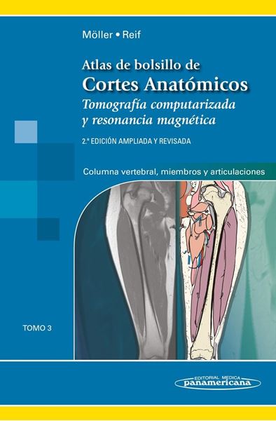 Atlas de Bolsillo de Cortes Anatómicos "Tomo 3. Tomografía computarizada y resonancia magnética: Columna vertebral, miembros y articulaciones"