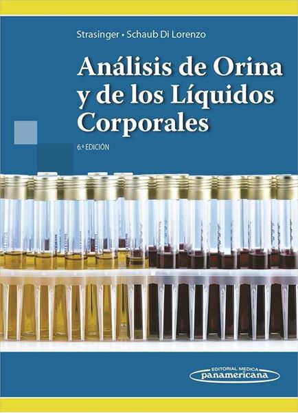 Análisis de orina y de los líquidos corporales