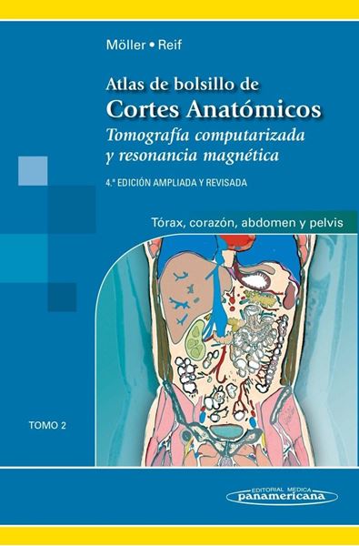 Atlas de bolsillo de cortes anatómicos Tomo 2 "Tomografía computarizada y resonancia magnética"