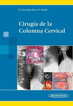 Cirugía de la Columna cervical