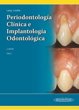 Periodontología clínica e implantología odontológica "Tomo 2"
