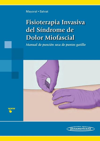 Fisioterapia Invasiva del Síndrome de Dolor Miofascial