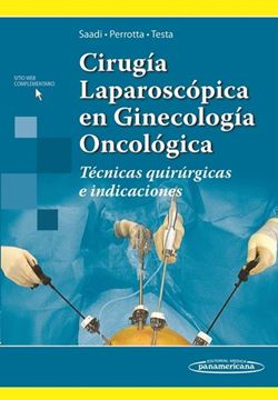 Cirugía Laparoscópica en Ginecología Oncológica "Técnicas quirúrgicas e indicaciones"