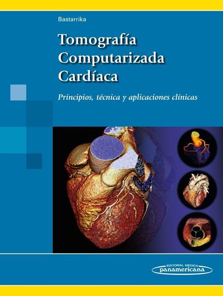 Tomografía Computarizada Cardíaca "Principios, técnica y aplicaciones clínicas"