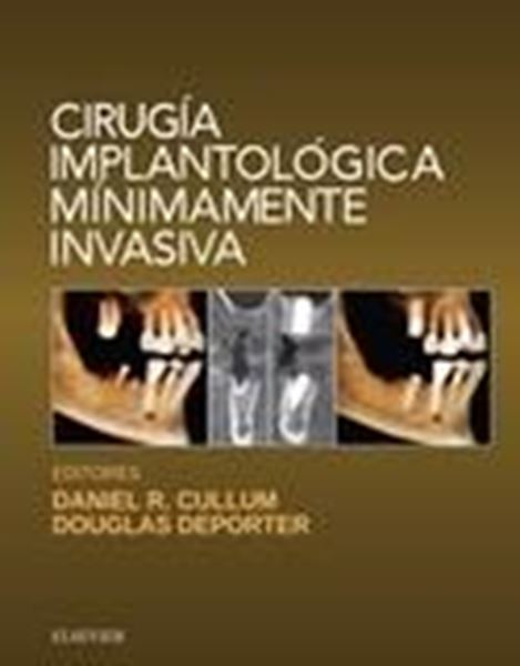 Cirugía implantológica mínimamente invasiva, 1ª 2017