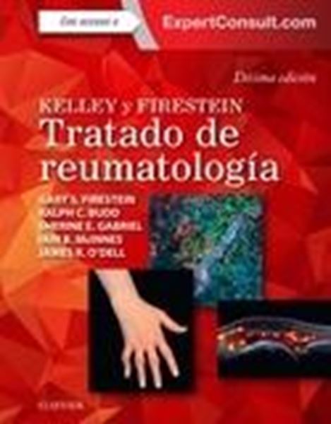 Kelley y Firestein. Tratado de reumatología + ExpertConsult (10ª ed.) 2018 "En dos volúmenes"