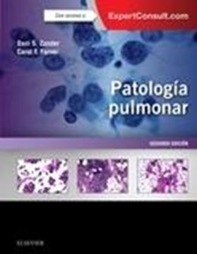 Patología pulmonar + ExpertConsult (2ª ed.)
