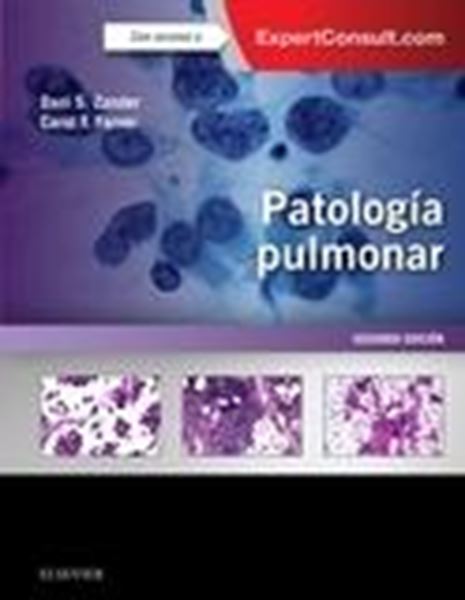 Patología pulmonar + ExpertConsult (2ª ed.)