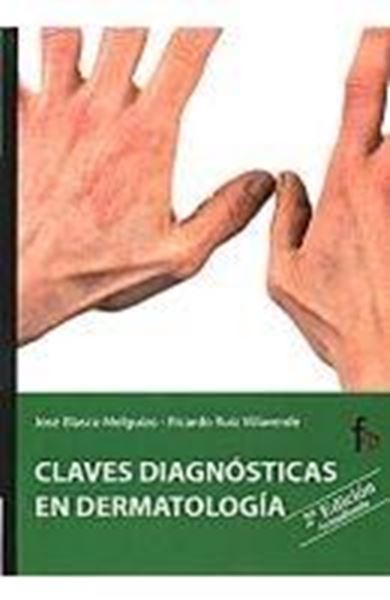 Claves Diagnósticas en Dermatología