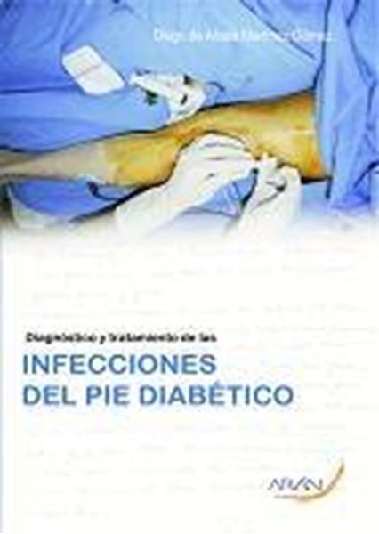 Diagnóstico y Tratamiento de las Infecciones del Pie Diabético