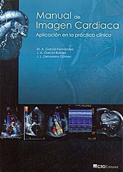 Manual de Imágen Cardiaca. Aplicación en la Práctica Clínica