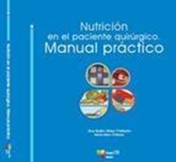 Nutrición en el Paciente Quirúrgico. Manual Práctico