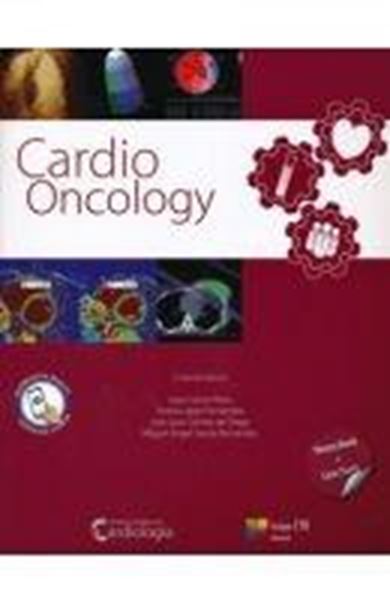 Cardio Oncology 2 tomos (2015)