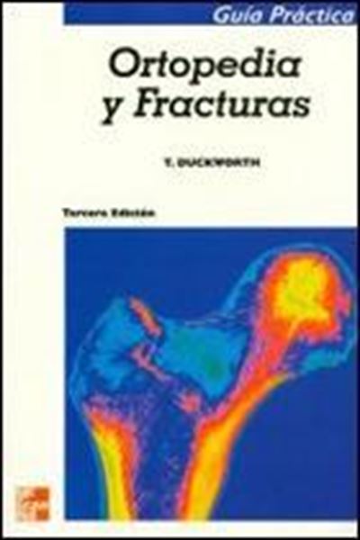 Ortopedía y Fracturas