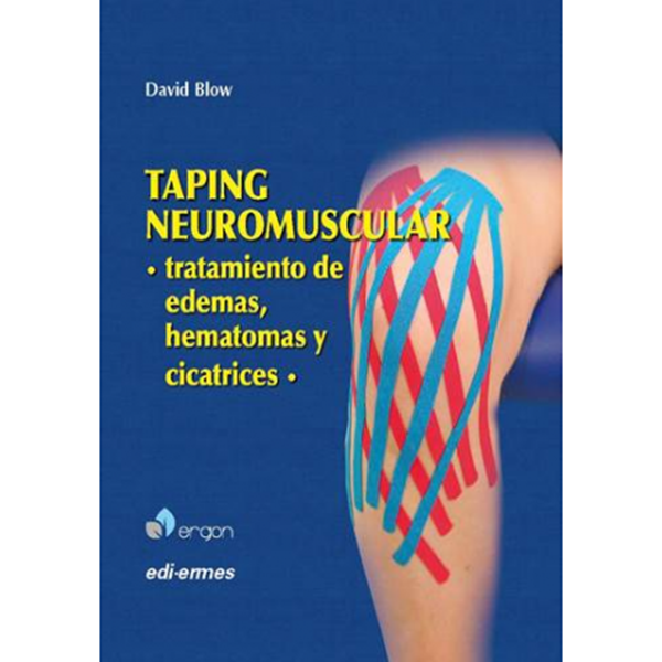 Imagen de Taping neuromuscular: Tratamiento de edemas, hematomas y cicatrices