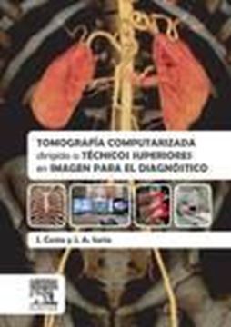 Tomografía computarizada dirigida a técnicos superiores en imagen para el diagnó