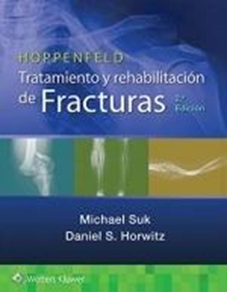 Hoppenfeld. Tratamiento y rehabilitación de fracturas, 2022